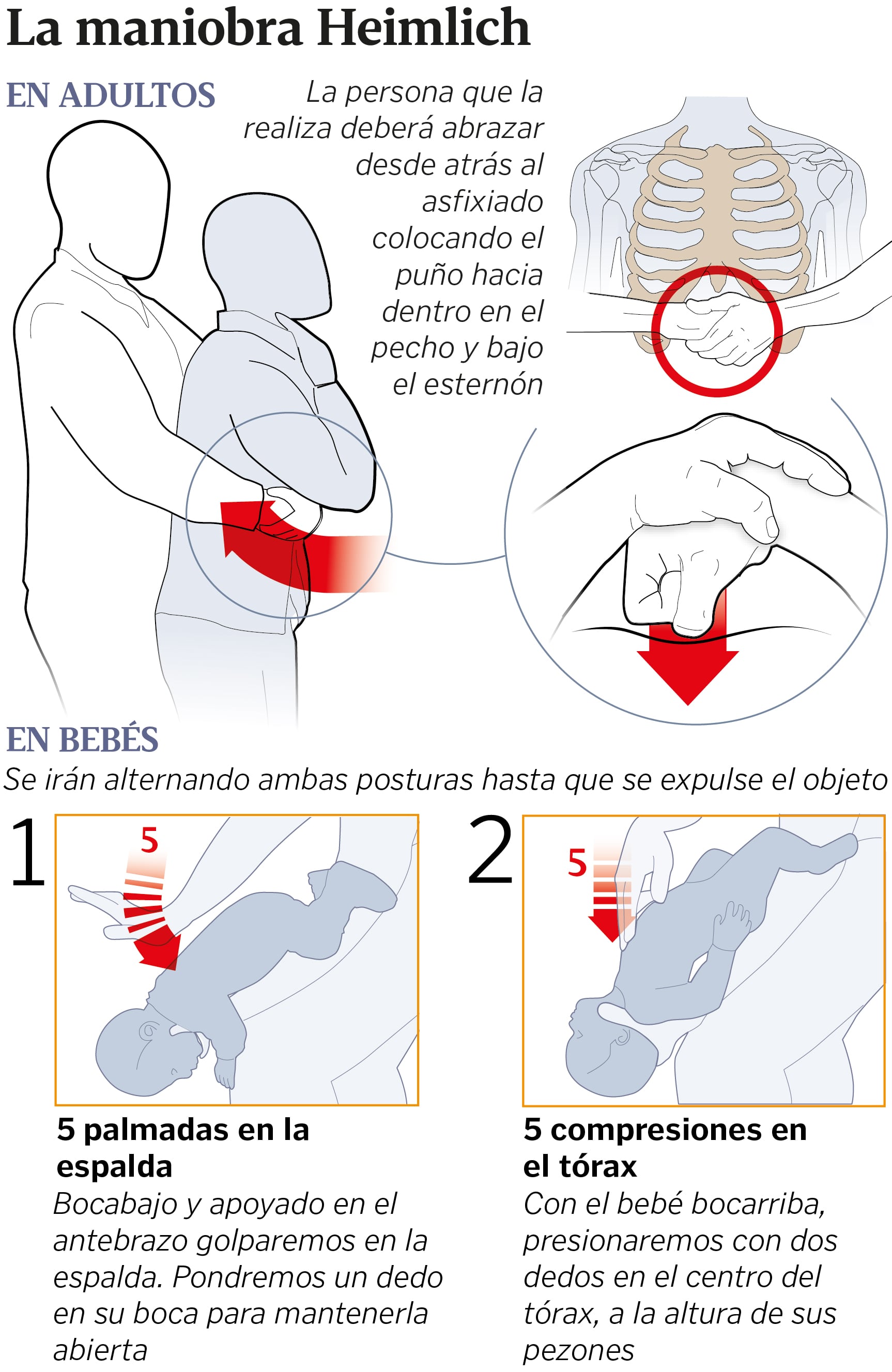 Pasos para hacer la maniobra Heimlich. Foto: Web