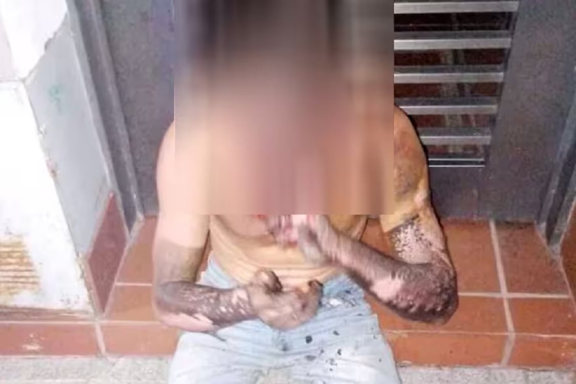 El delincuente ingresó dentro de la zanja, intentó cortar parte del cableado con un cuchillo serrucho - La Nación