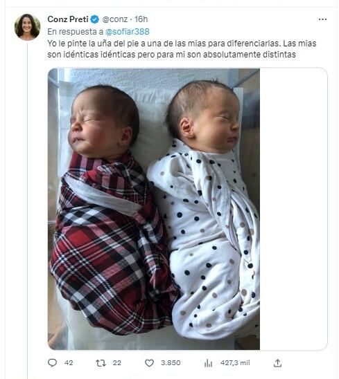 La usuaria @conz contó que para diferenciar a sus hijas le pintó una uña del pie a una de ellas. 