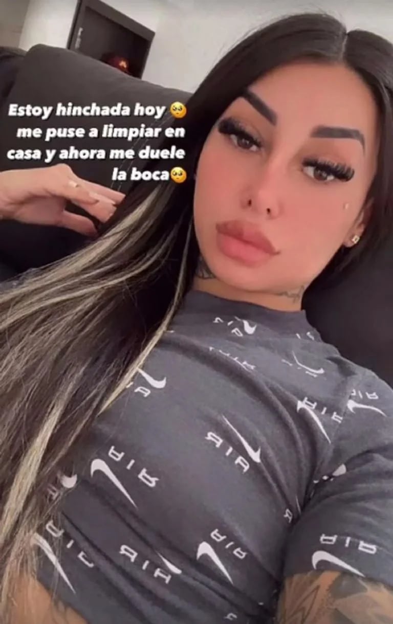 Tamara Báez se hizo una cirugía, mostró cómo le quedó la cara y preocupó a sus seguidores de Instagram