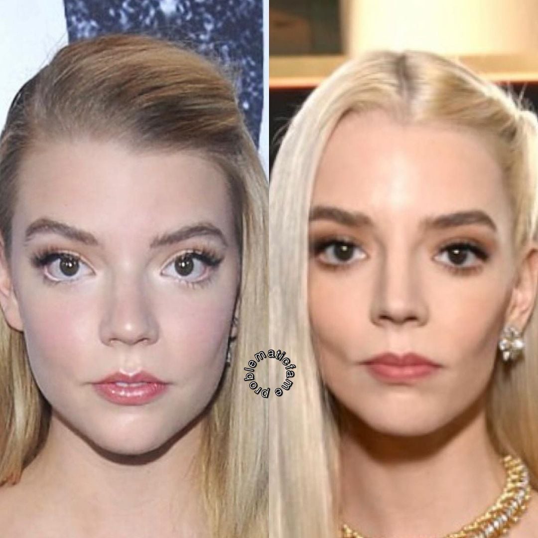 Las fotos que muestran las diferencias de Anya Taylor Joy con el paso de los años. 