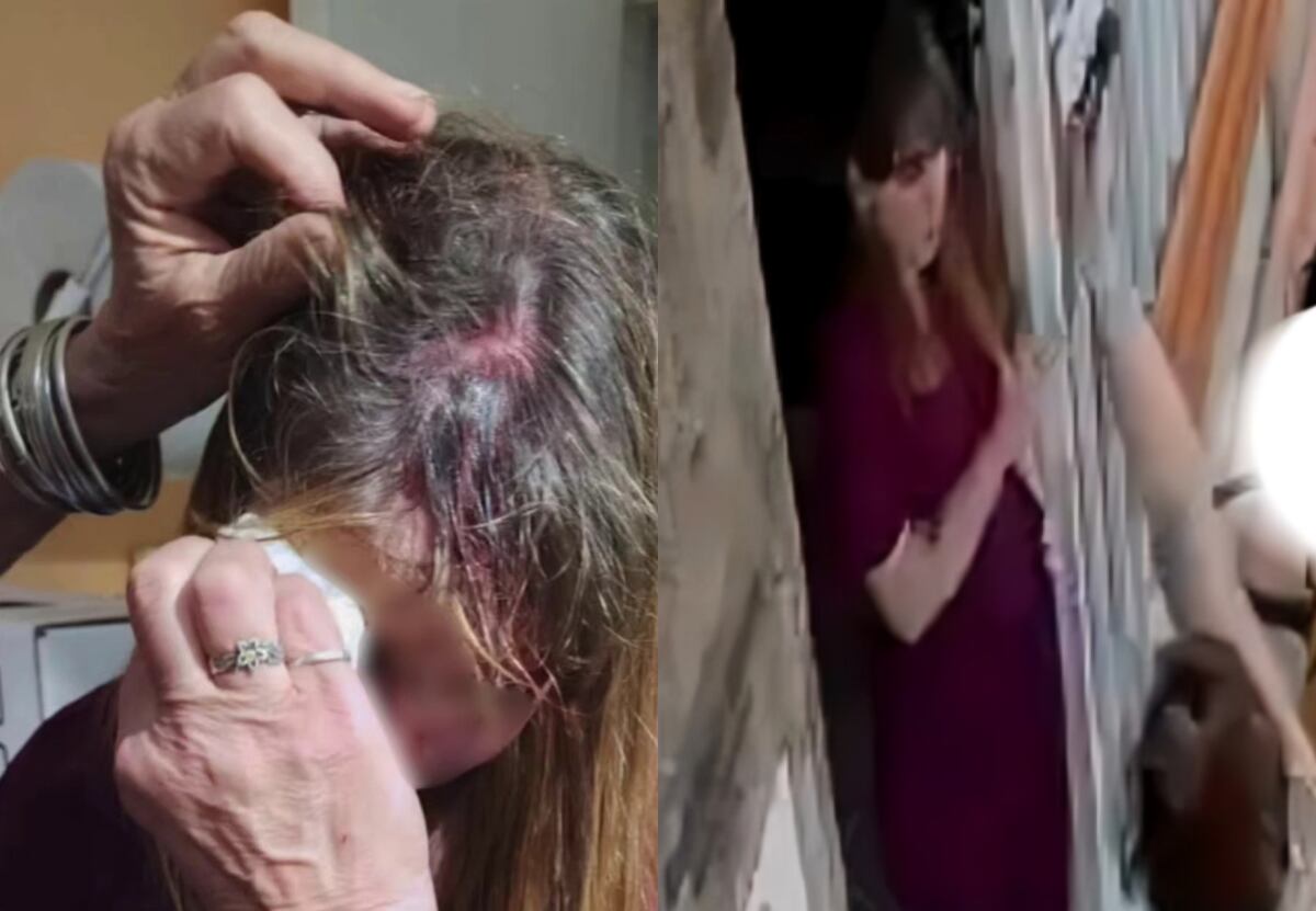 “Me intentó matar”: el brutal ataque sufrió una veterinaria en Córdoba