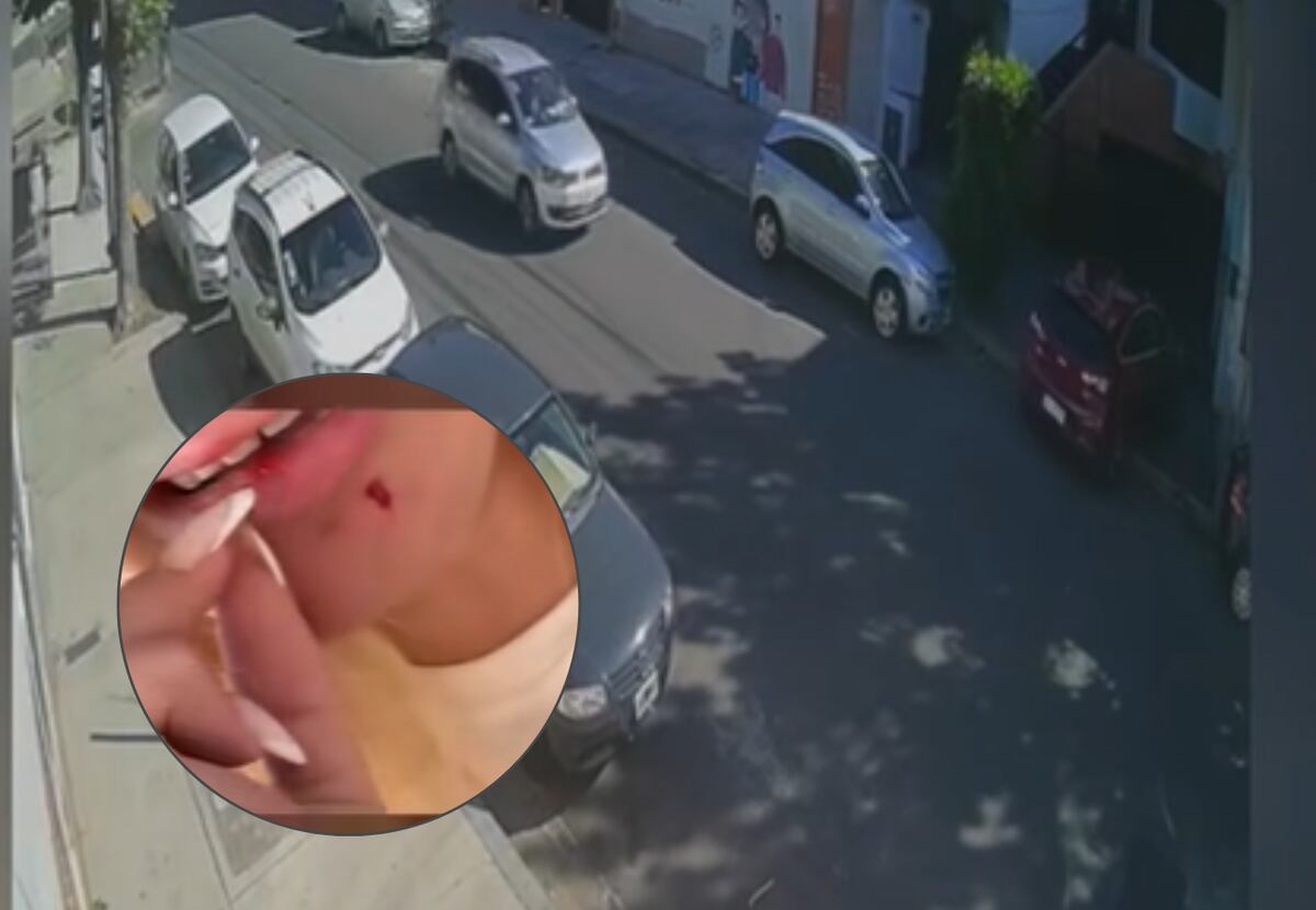 El violento ataque de un vecino a una joven en Villa del Parque por un auto mal estacionado: “Me pegó en la cara”