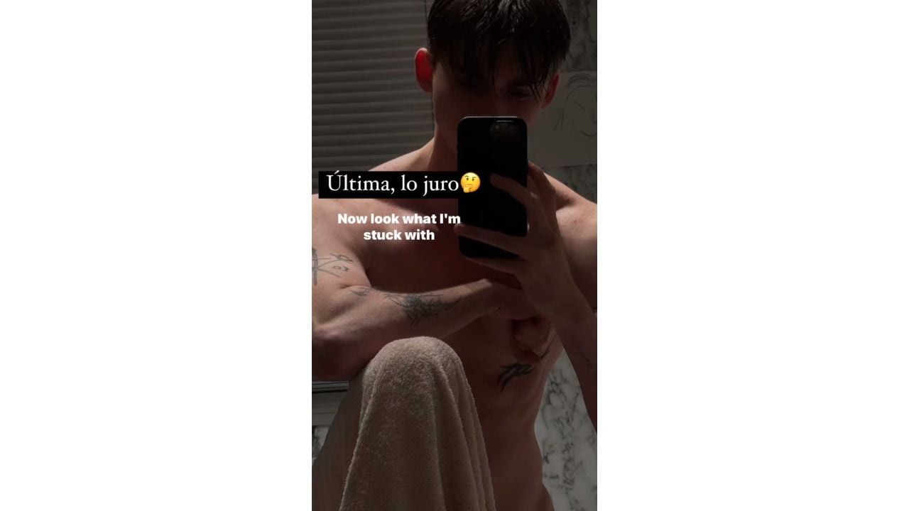 La foto de Felipe Fort que dejó en shock a sus fanáticos.