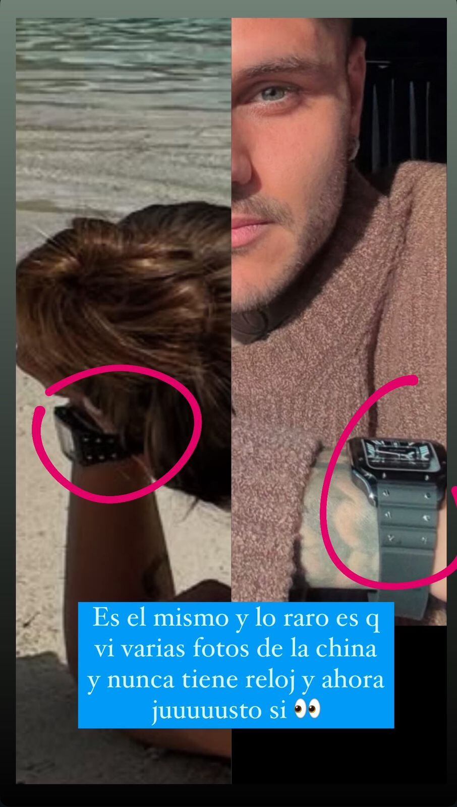 El reloj de Mauro Icardi.