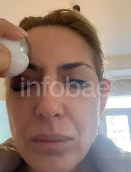 La nueva imagen de Fabiola Yáñez golpeada