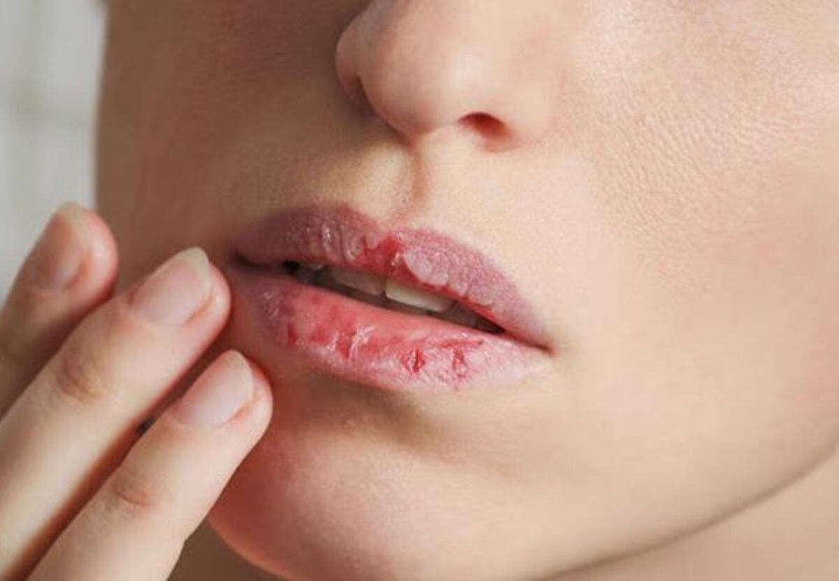 El truco definitivo para reparar los labios resecos en invierno: la técnica con solo dos productos
