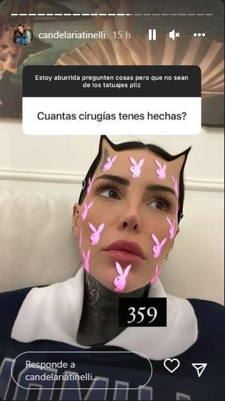 La irónica respuesta de Cande Tinelli sobre sus cirugías