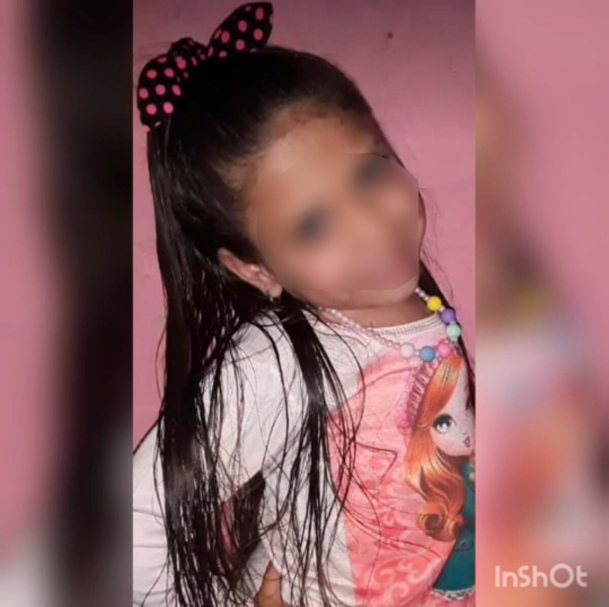Mahia, niña de Pérez con Síndrome de Morquio, necesita una silla de ruedas ortopédica