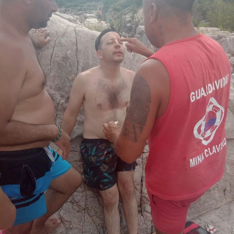 Turista hizo un clavado y terminó fracturándose el tabique.