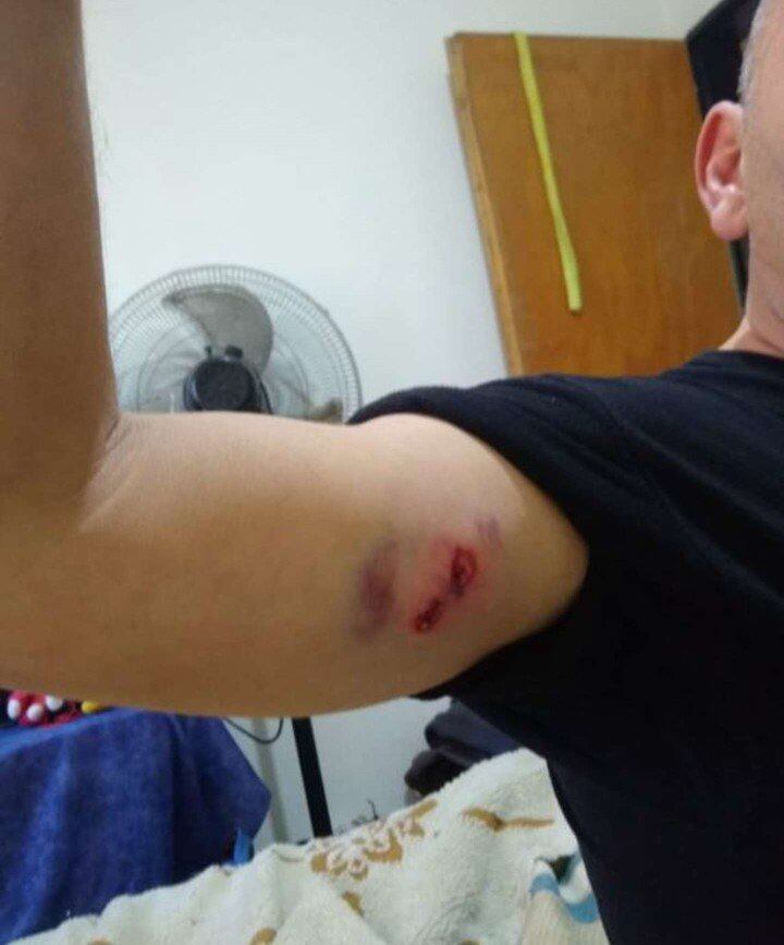 La bala ingresó en su brazo