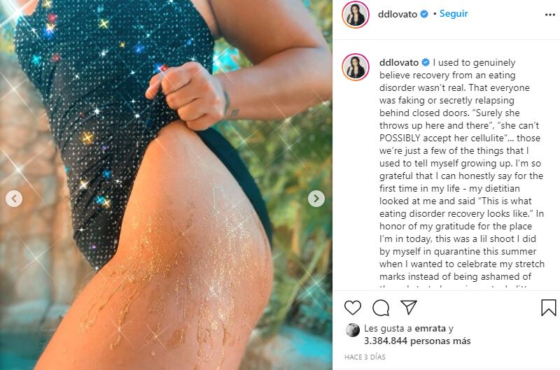 Demi Lovato muestra sus estrías con purpurina dorada