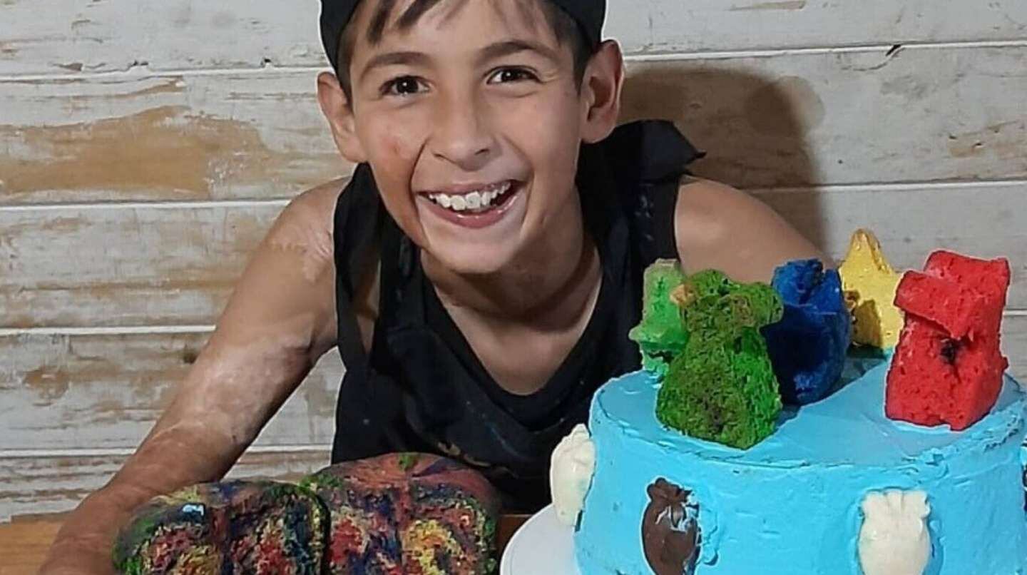 El nene de 10 años se hizo viral por vender tortas para la operación de piel que necesita.