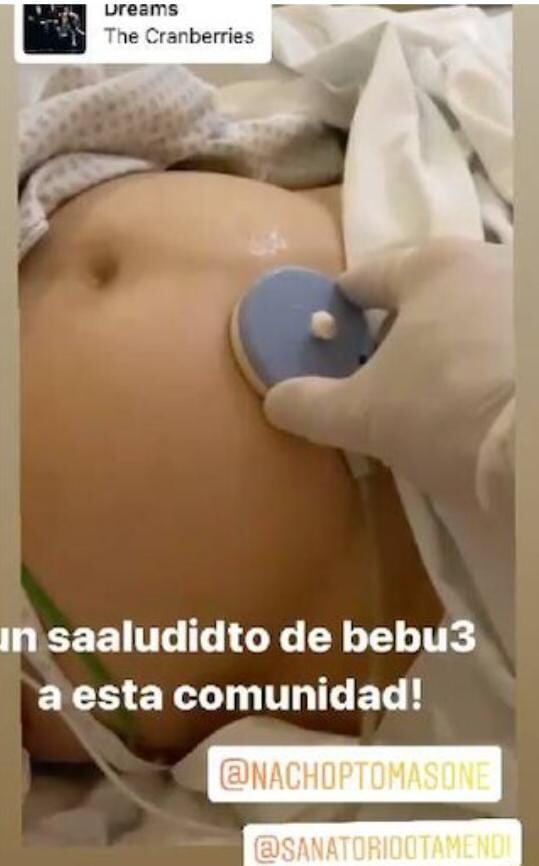 Karina Gao compartió una imagen de su panza mientras le hacían un control en su cuenta de Instagram.