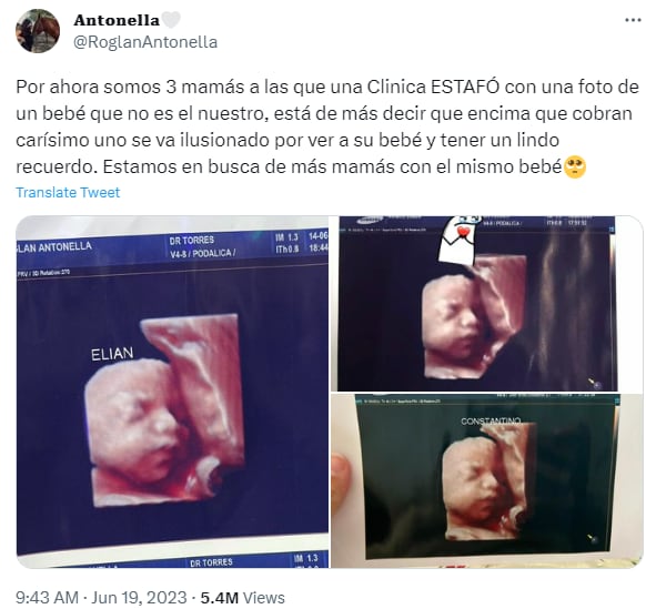 Denunciaron a una clínica de Formosa por cobrarles por ecografías 5D truchas.