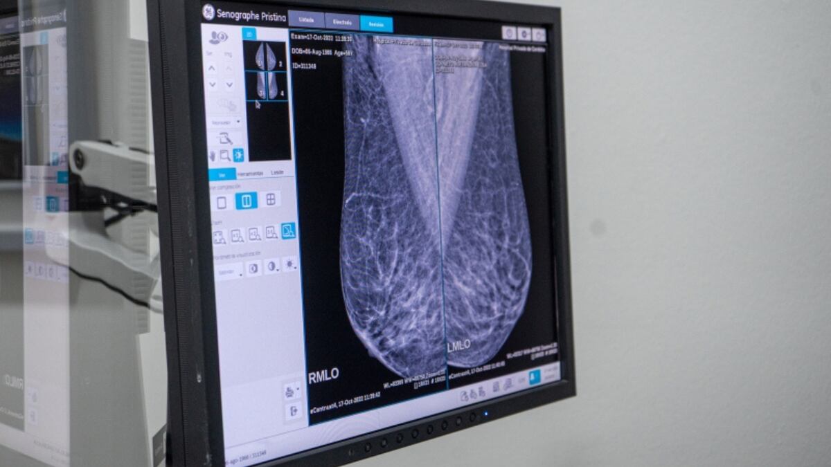 Cáncer de mama en Córdoba: es curable en el 90% de los casos detectados de manera temprana