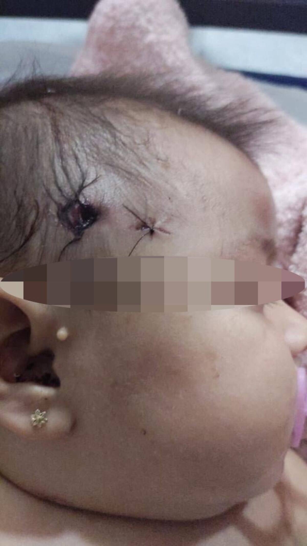 Una bebé de cinco meses recibió un disparo en la cabeza durante una persecución policial