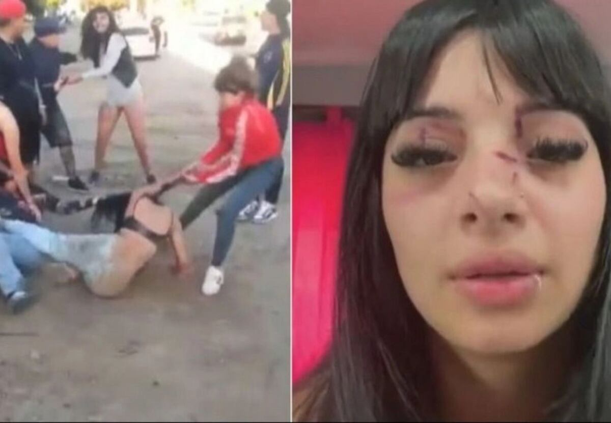 La reconocieron de TikTok y la atacaron a golpes “por ser linda” a la salida de un boliche: “Me desmayé”