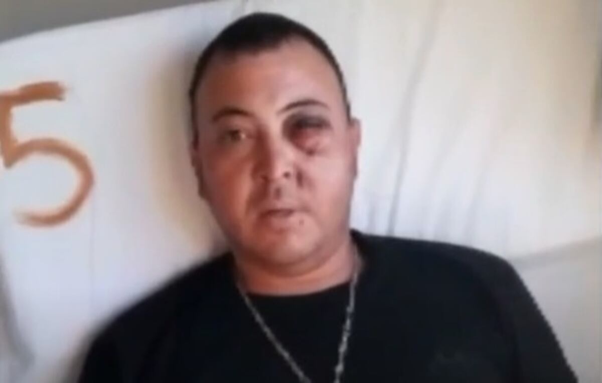 Un hincha de Gimnasia podría perder un ojo tras la represión policial: “Hoy ya no veo”