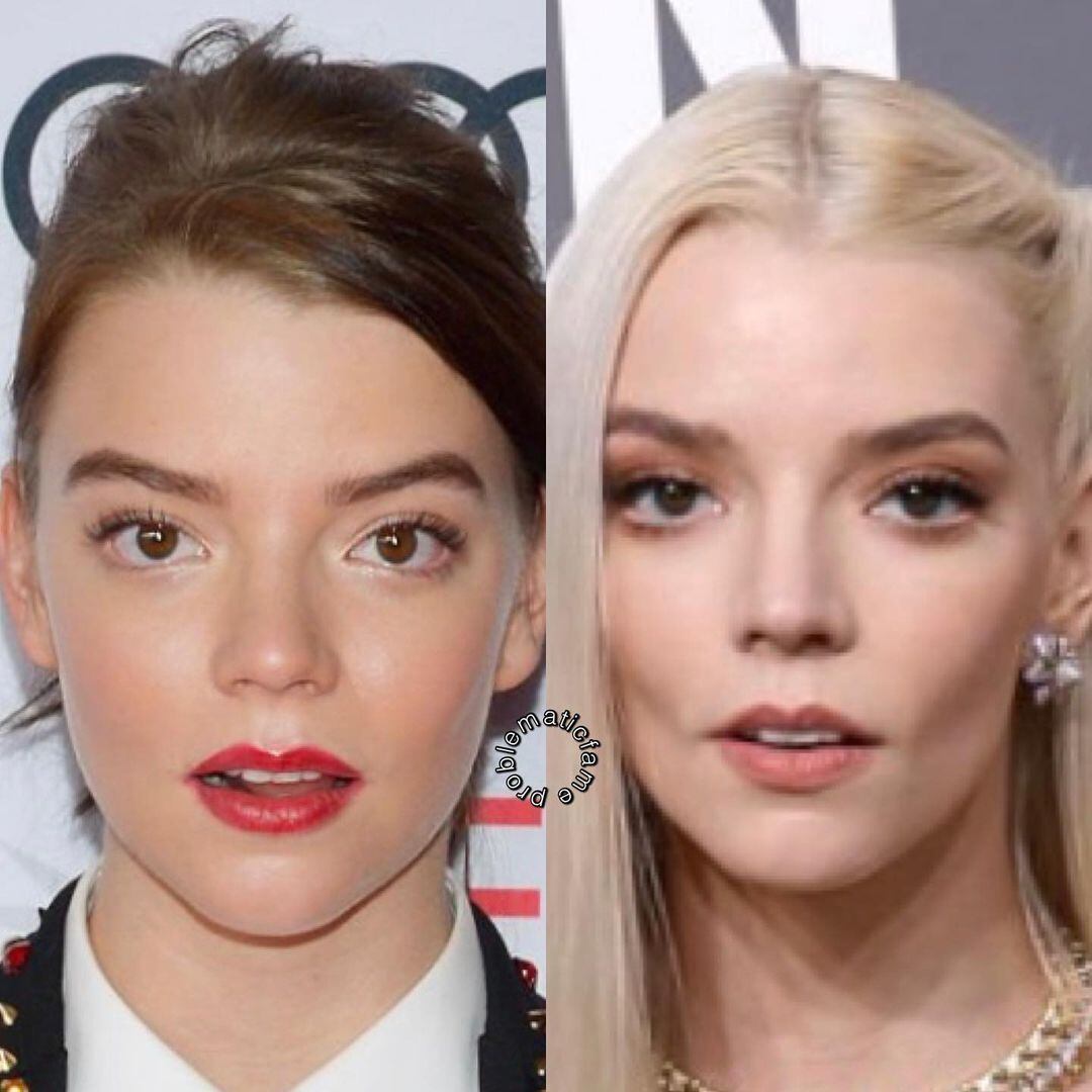 Un usuario de Instagram comparó el rostro de Anya Taylor-Joy en 2016 y ahora