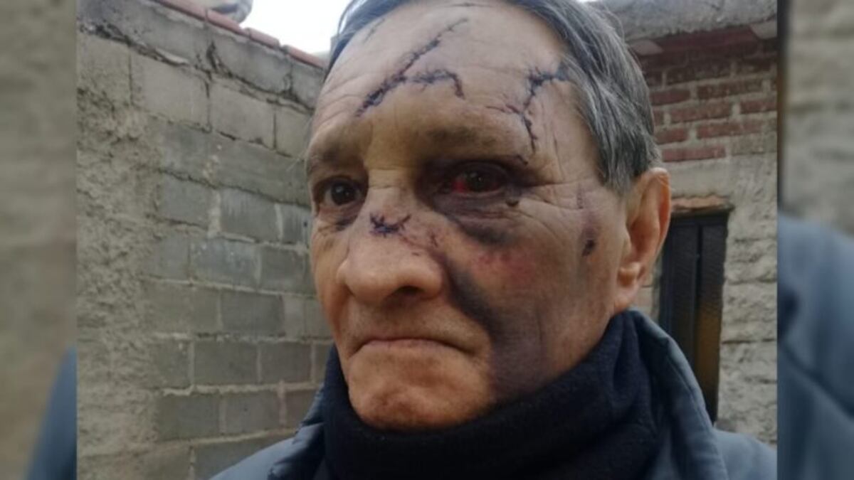 Villa Mercedes: lo golpearon con un martillo en la cabeza para robarle