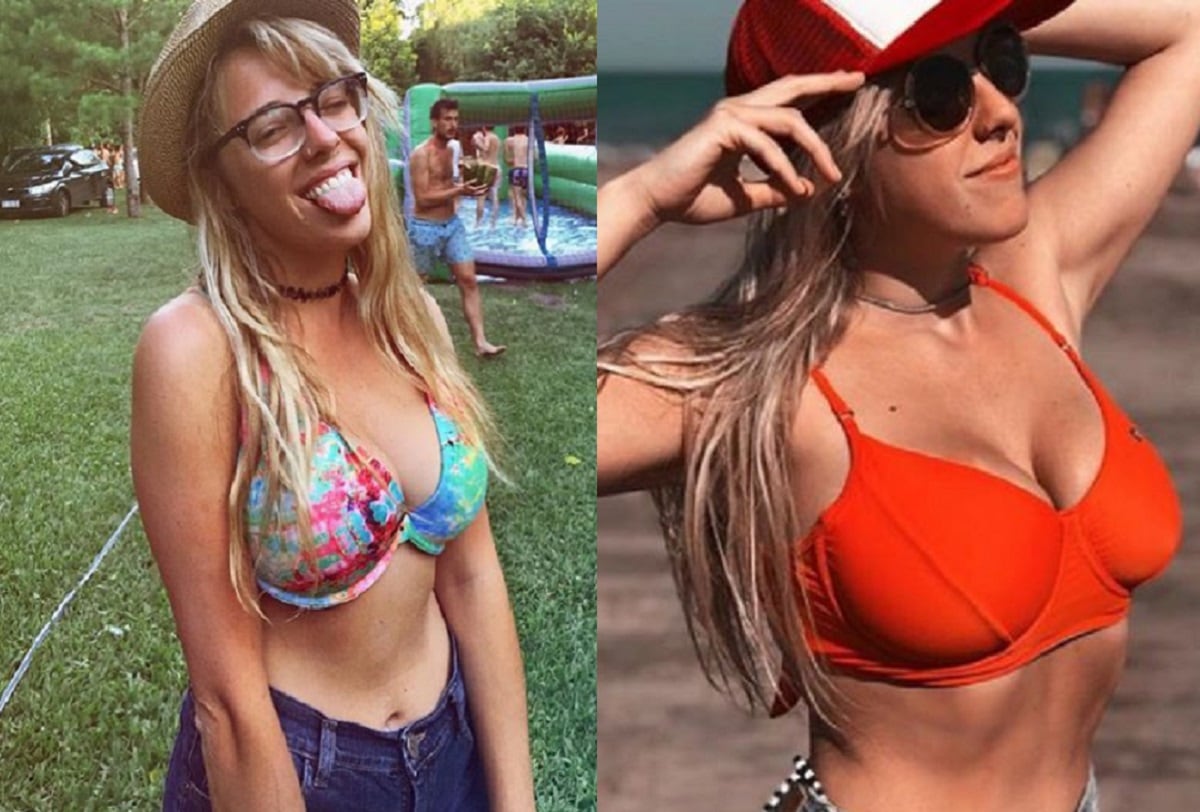 Antes y después: Nati Jota mostró cómo quedaron sus nuevas lolas