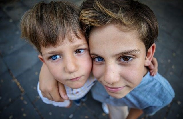 Los hermanos oriundos de Turquía tienen el ojo derecho de color azul mientras que el ojo izquierdo es marrón oscuro.