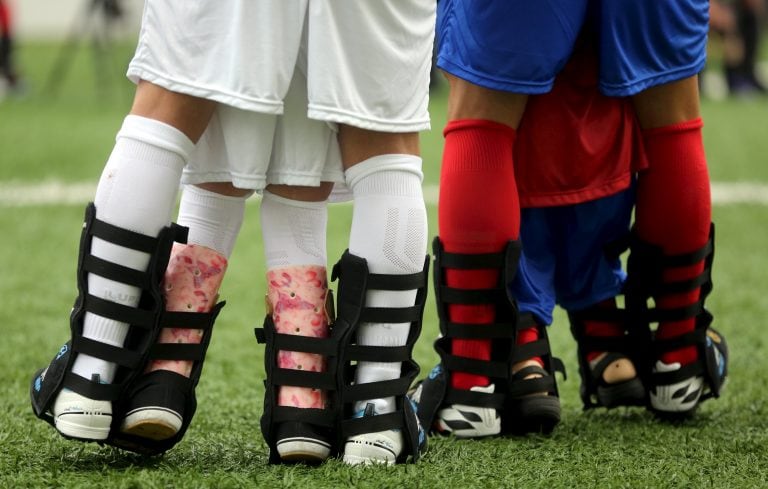 pierna piernas de los futbolistas jugadores atadas con los chicos con discapacidades
Disabled children and Brazilian soccer players attend a "World Boots" event for children with disabilities, at the Neymar Institute in Praia Grande, Brazil July 7, 2015. REUTERS/Paulo Whitaker brasil  evento World Boots botas del mundo futbol partido con chicos discapacitados