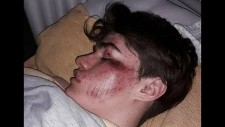 El joven de 17 años fue presuntamente golpeado de manera feroz por un patovica en General Cabrera. ( FM La Voz de la Amistad)