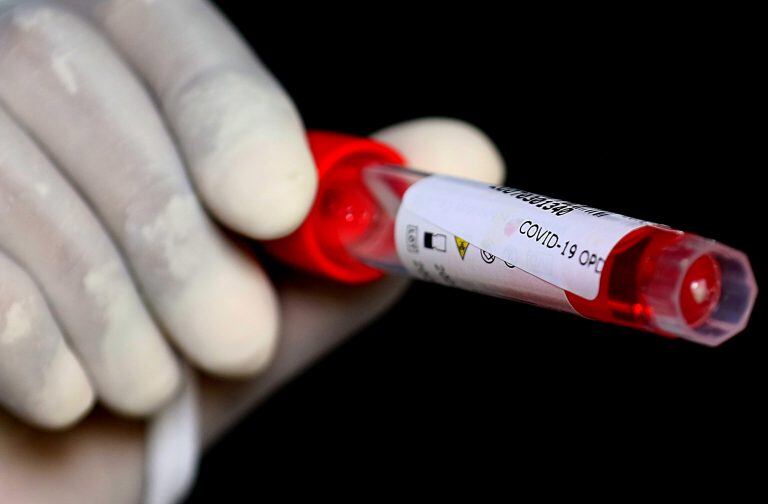 Test por coronavirus. EFE/EPA/SHAHZAIB AKBER