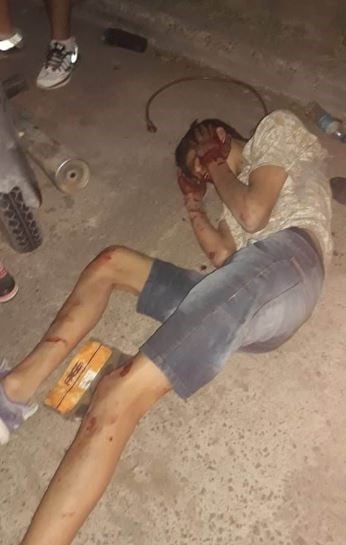 Uno de los motochorros resultó herido y fue trasladado al hospital, donde quedó internado bajo custodia policial. (Foto: Época)