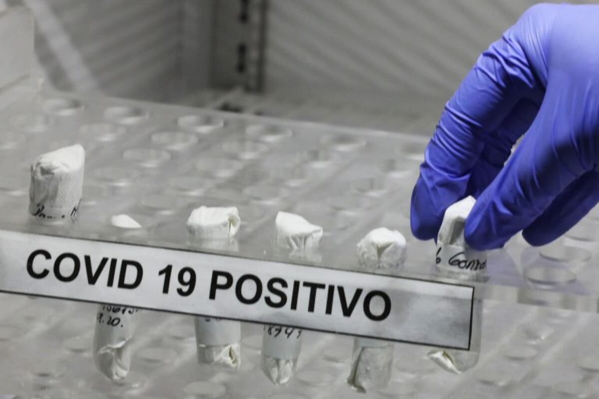 Salta sumó 67 nuevos casos de COVID-19 y San Martín es el departamento más complicado