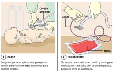 Así es la donación de sangre de cordón umbilical. (Foto: El Litoral)