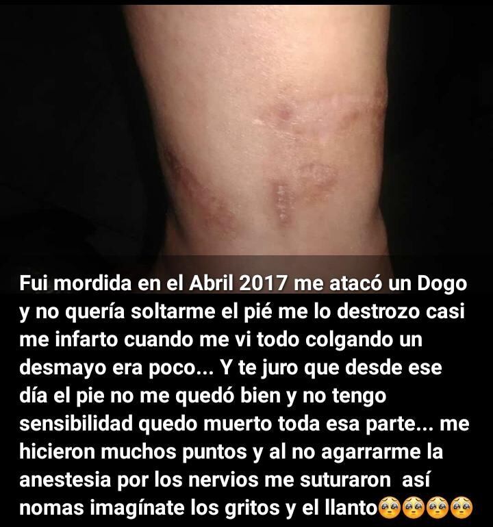 Problema de los perros de la calle