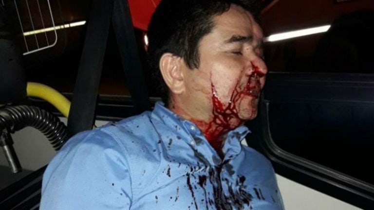 Chofer agredido por delincuentes