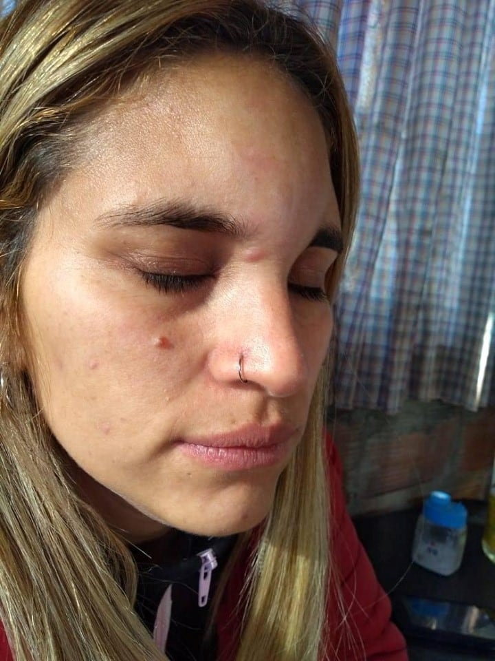 La mujer teme por su vida luego de denunciar a su expareja 16 veces (web).