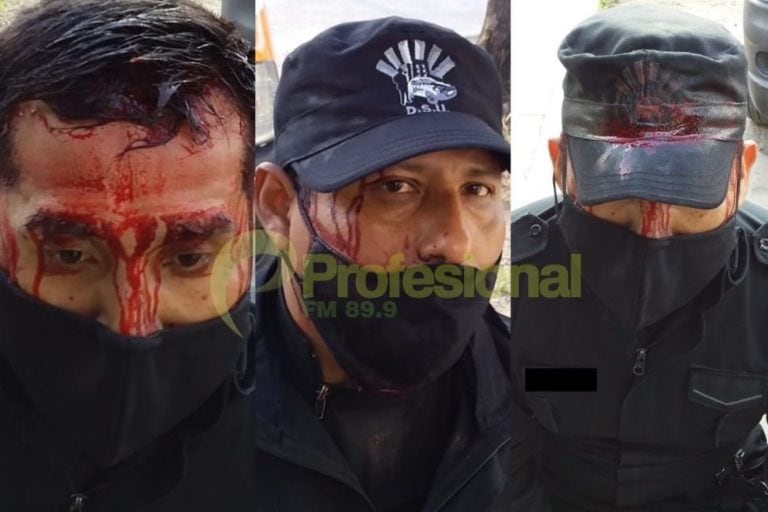 Brutal ataque a policías que intentaron parar un partido de fútbol. (Policía de Salta)