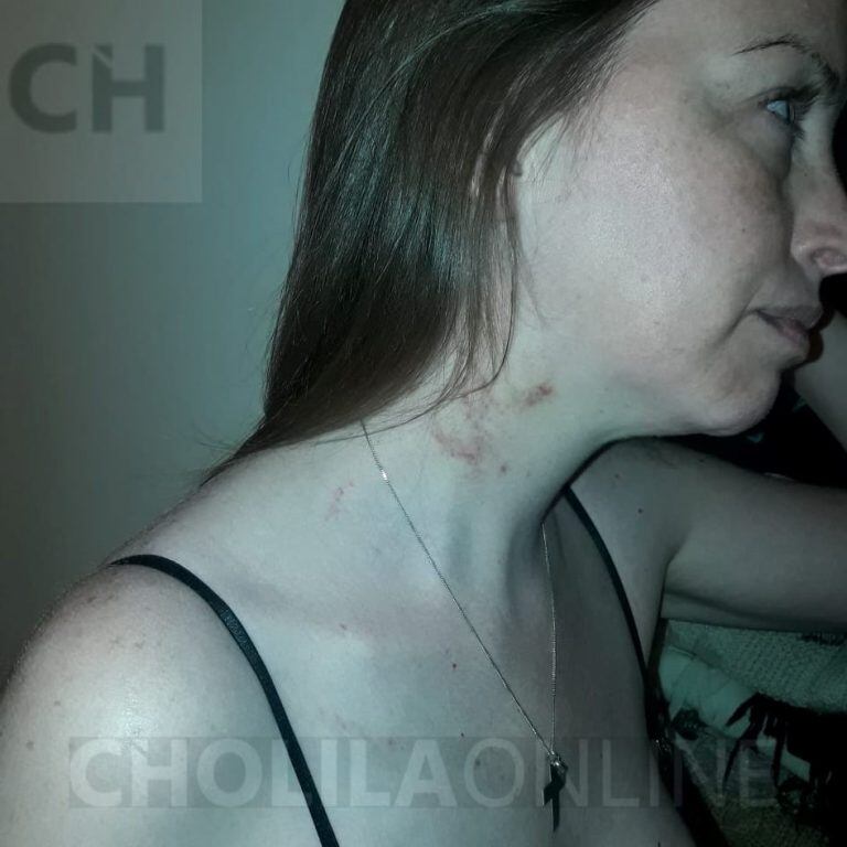 La mujer denuncia violencia de género. Foto Cholila OnLine