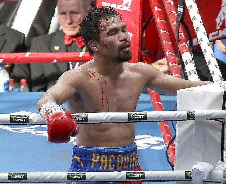 Manny Pacquiao of the Philippines reacts after his loss during their WBO World Welterweight title fight in Brisbane, Australia, Sunday, July 2, 2017. (AP Photo/Tertius Pickard) brisbane australia Manny Pacquiao pelea por el titulo categoria welter boxeo box pelea boxeador boxeadores