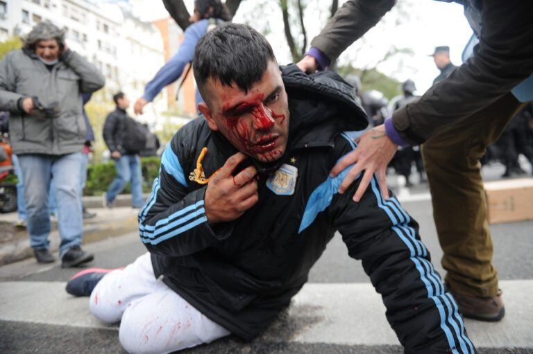 Accidentes en la 9 de Julio (crédito: Juano Tesone)