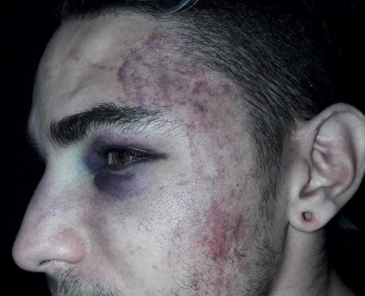 Jóvenes denunciaron haber sido brutalmente agredidos por la policía