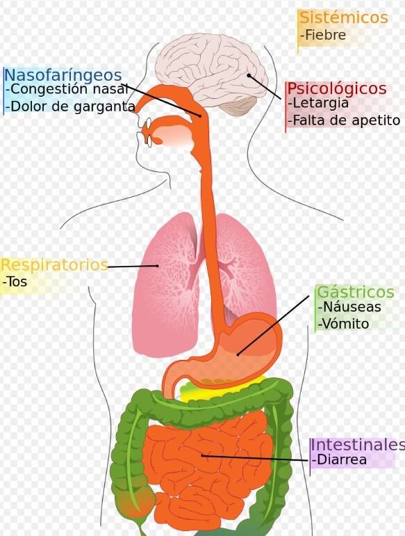 Síntomas de la llamada "Gripe porcina". (Web)