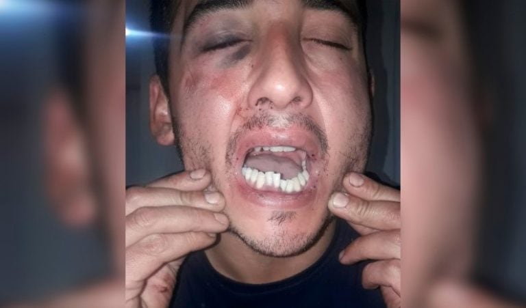 El joven que denuncia la brutal golpiza es de Río Cuarto.