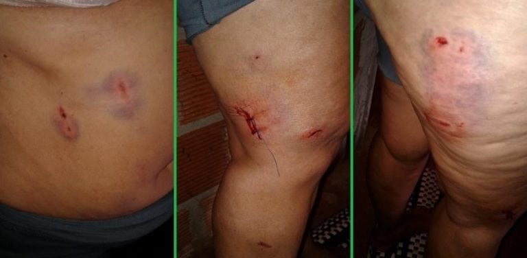 La denunciante exhibió las heridas que sufrió por los perros de sus vecinas.