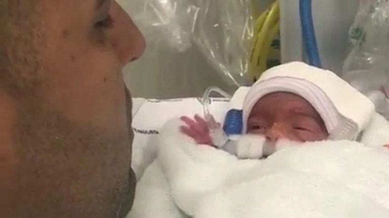 Su bebé pesó 930 gramos y midió 34 centímetros. Se llama Sophia y está internada en la unidad de cuidados intensivos neonatalas del hopistal privado Pro Matre Paulista donde deberá quedarse al menos dos meses más. Crédito: Gentileza NOTICIAS FOCUSON.