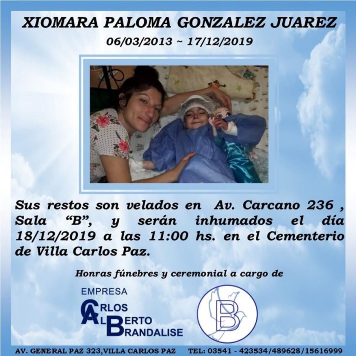 Carlos Paz: falleció Xiomara, la pequeña carlospacense con "piel de cristal"