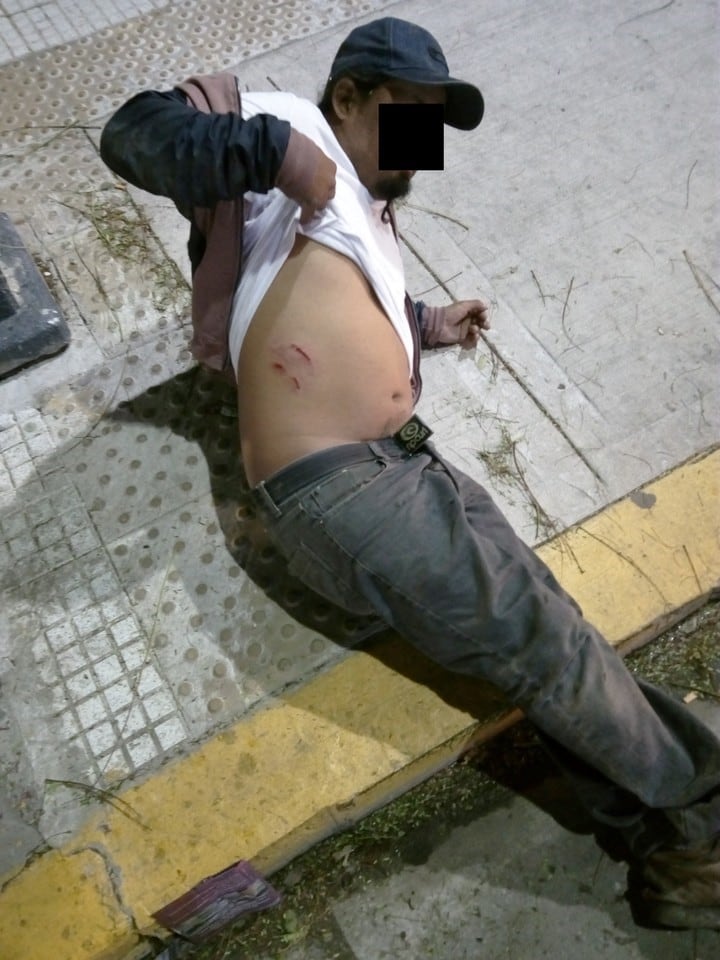 Hombre apuñalado a metros del Obelisco (crédito: Clarín)