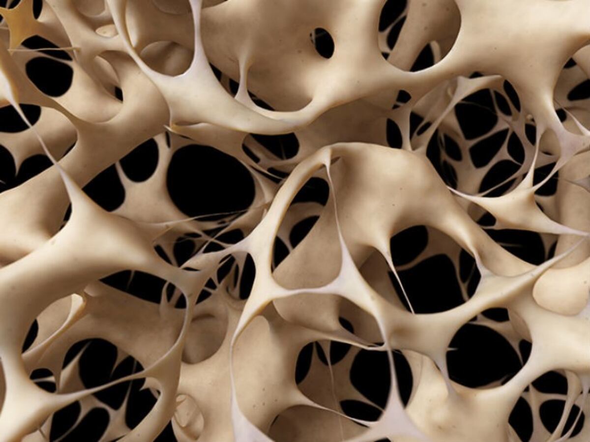 La adolescencia es la etapa ideal para prevenir la osteoporosis