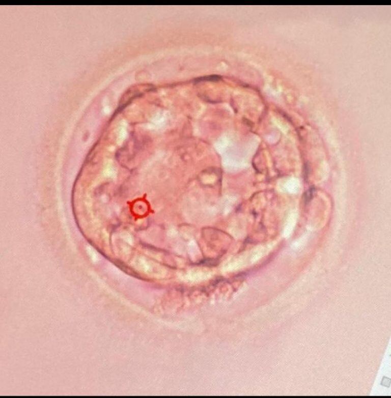 El embrión de Guadalupe antes de ser fertilizado en Romina. (Foto: gentileza Julián Mondragón).