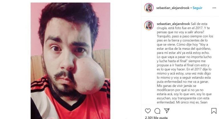 Sebastián Amurín D’Amico padece un sarcoma embrionario en el maxilar derecho y será operado en Mendoza (Foto: Instagram)